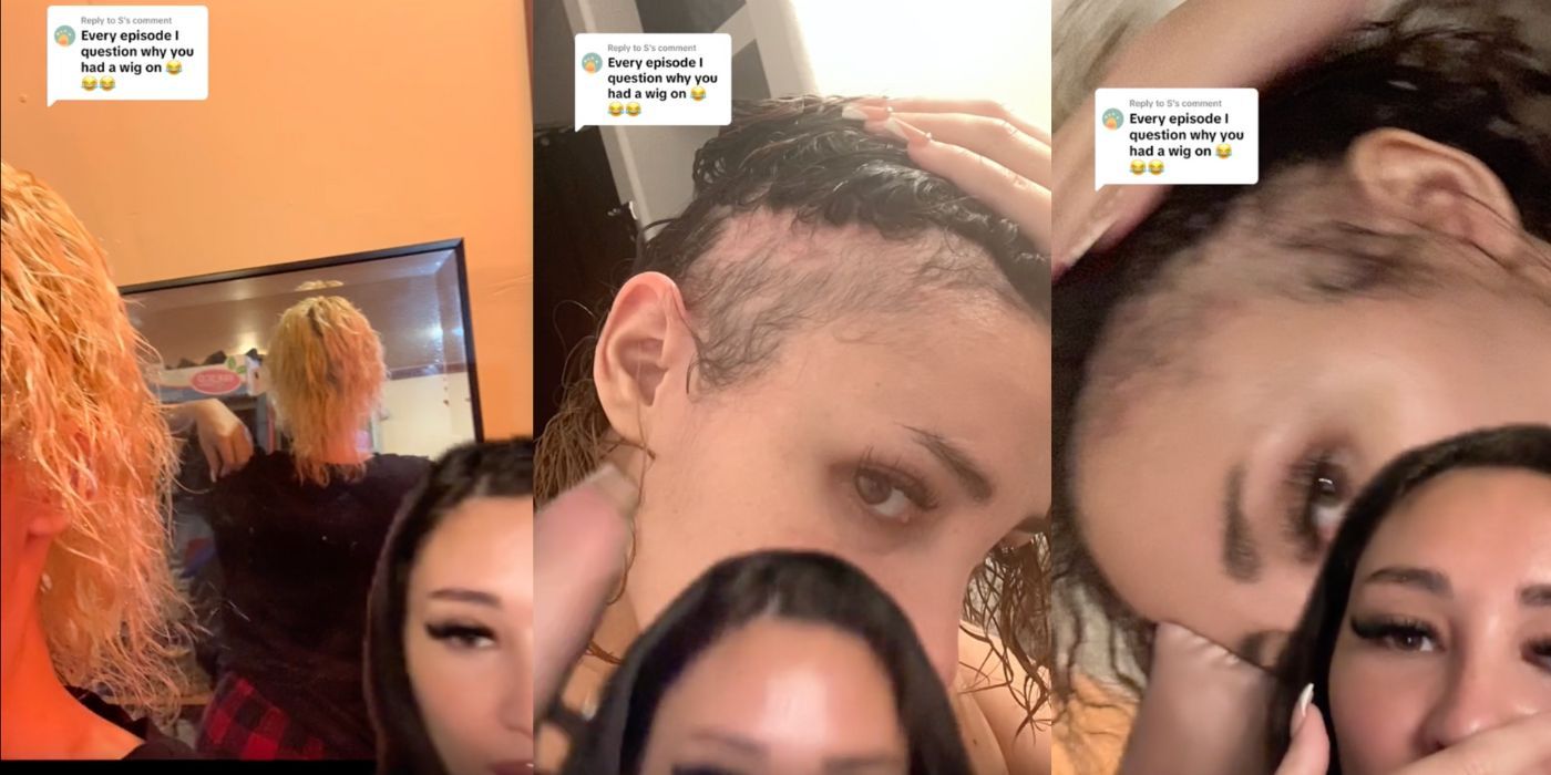 Sophie en Prometido de 90 Días muestra su cabello y calvicie por el estrés