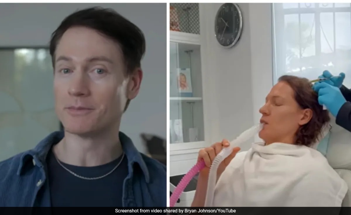 Tech Millionaire dice que restauró su cabello usando 3 técnicas: ''Buen momento...''
