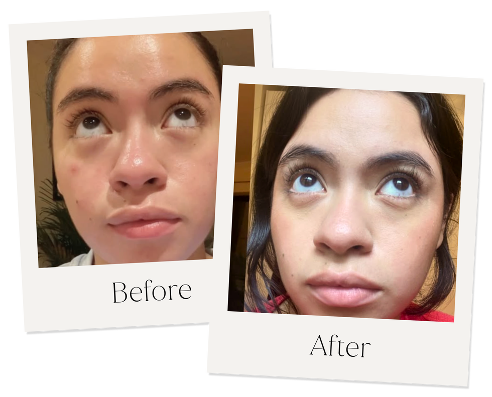 antes y después